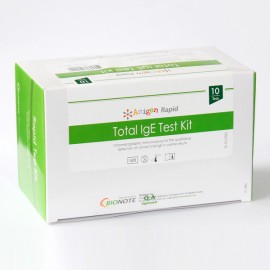 IgE TOTALES (Prueba de referencia de alergias)
